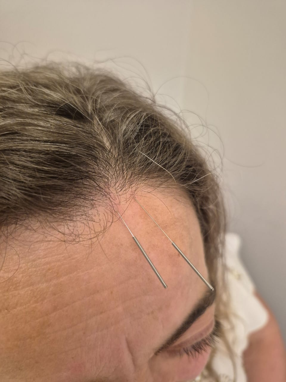 Cranioterapia